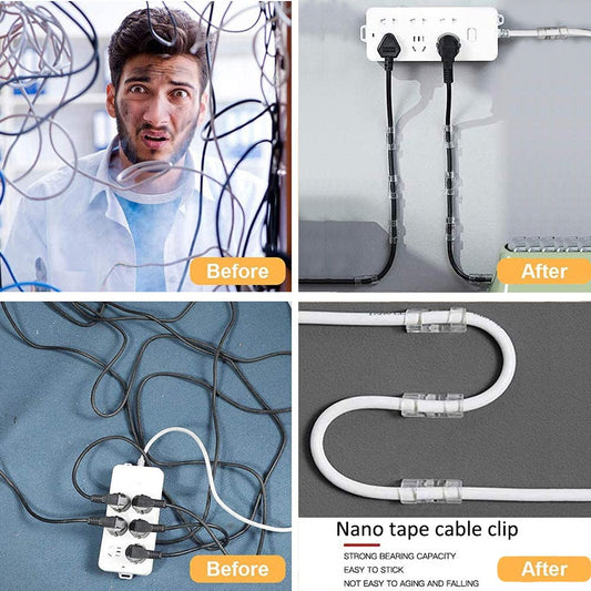 20pcs Self-Adhesive Wire Clip Stickers – Clear Cable Organizer Clips, Multi-Purpose Wire Ties Fixer & Cord Management Buckle Packet